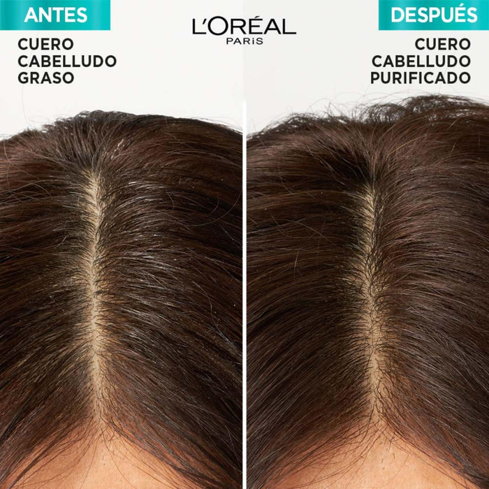Pack Shampoo + Acondicionador Elvive Hialuronico Pure 370Ml